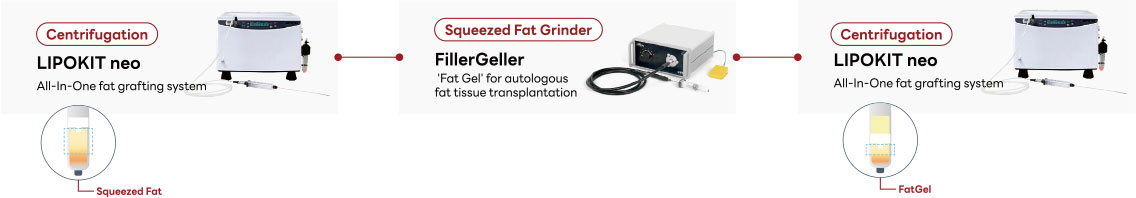 Fat-Derived Graft Material