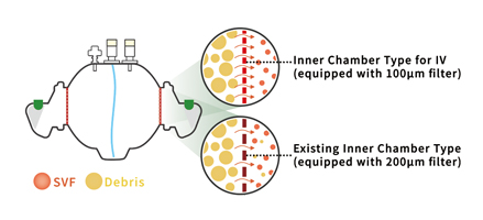 Dedicated Inner Chamber 