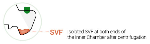 What is SVF 